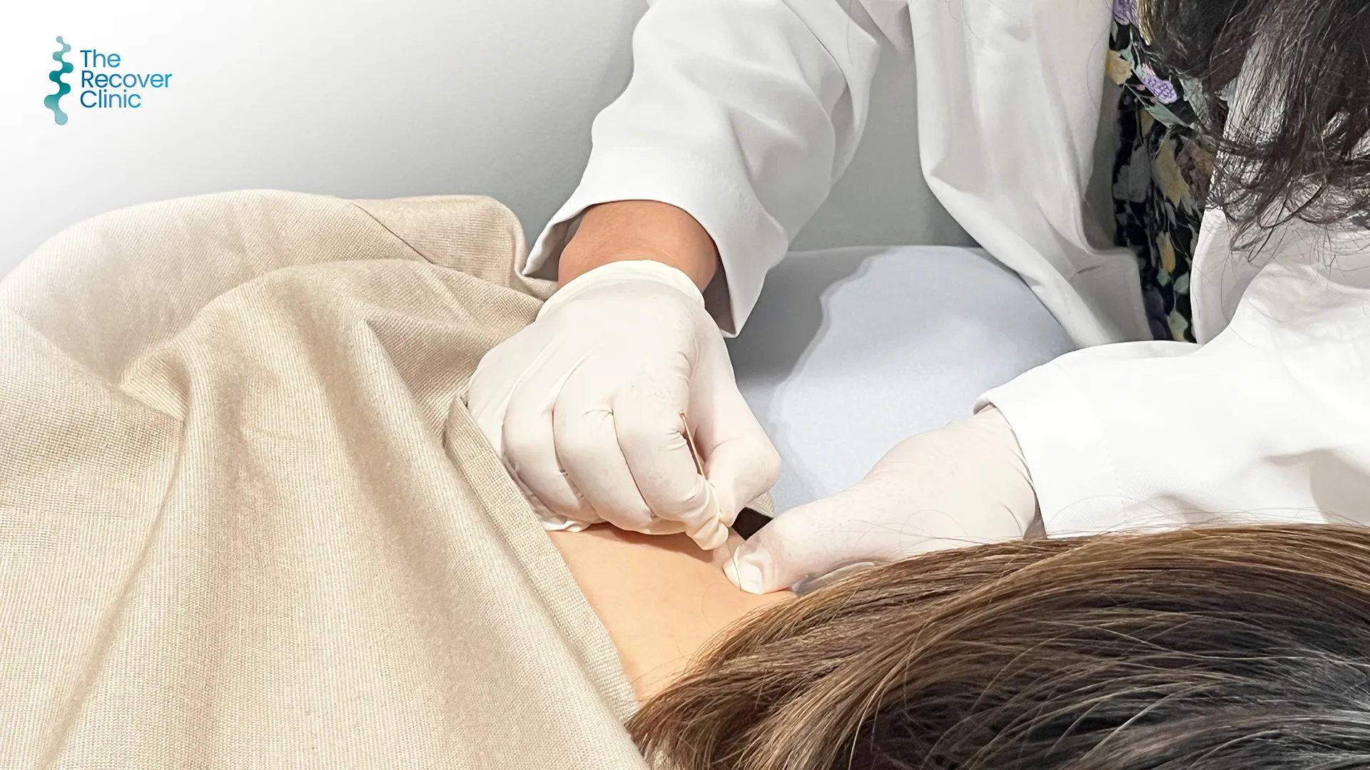 การลงเข็ม แบบ Dry Needling โดยแพทย์ผู้เชื่ยสชาญจาก The Recover clinic 